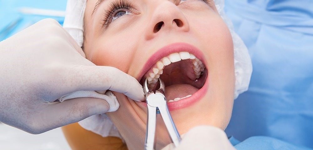 معرفی فورسپس های دندانپزشکی و کاربرد آنها