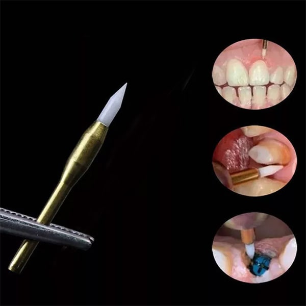 نحوه استفاده از فرز سرامیک