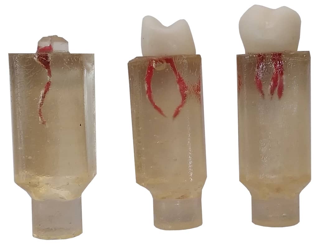 بلوک اندو برای آموزش عصب‌کشی | ابزار حرفه‌ای برای تمرین درمان ریشه