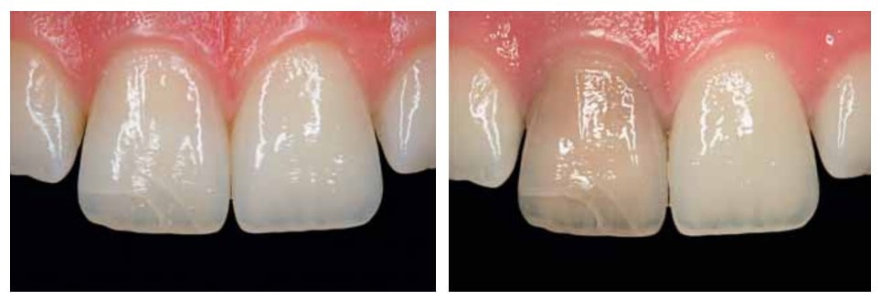 اندو بلیچ مروابن Endo Bleach Morvabon