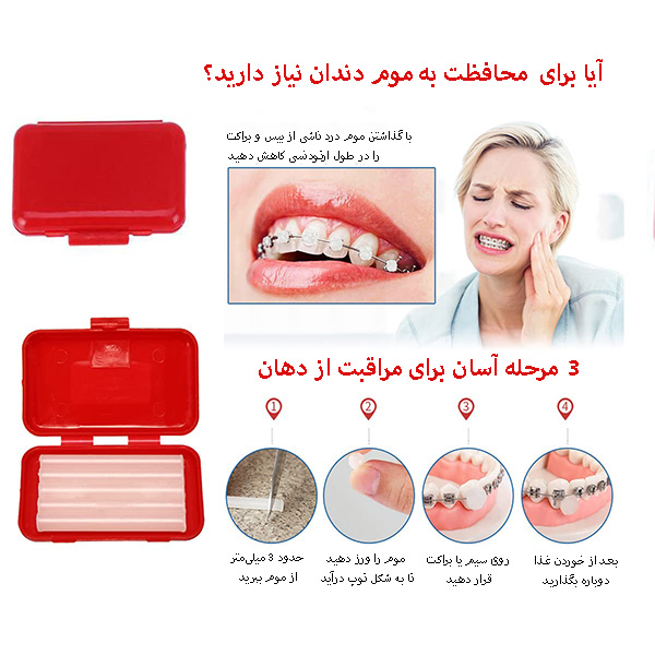 نحوه استفاده از موم ارتودنسی