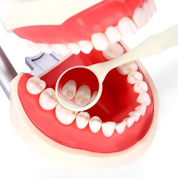 نحوه دید آینه دندانپزشکی روی کست