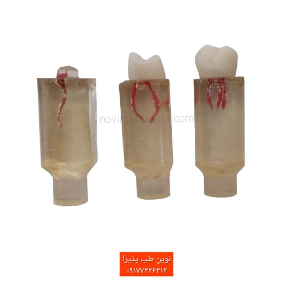 بلوک اندو برای آموزش عصب‌کشی | ابزار حرفه‌ای برای تمرین درمان ریشه